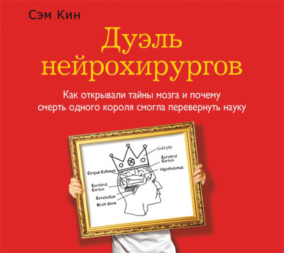 Дуэль нейрохирургов. Как открывали тайны мозга и почему смерть одного короля смогла перевернуть науку