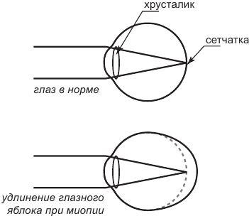 История очков, или Вооруженный взгляд