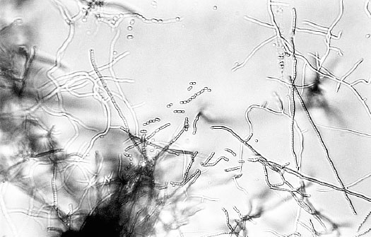 Homo Viridae: человек как вирус