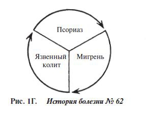 Мигрень