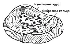 Кинезитерапия суставов и позвоночника