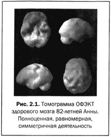 Великолепный мозг в любом возрасте