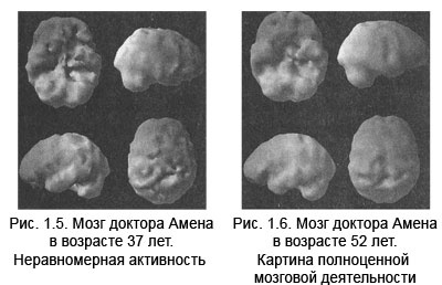 Измени свой мозг - изменится и тело!