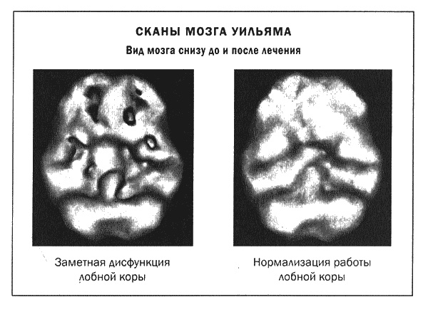 Мозг и душа. Новые открытия о влиянии мозга на характер, чувства, эмоции