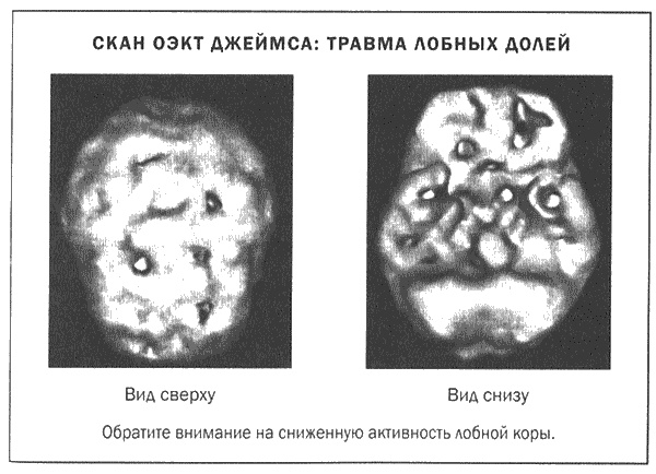 Мозг и душа. Новые открытия о влиянии мозга на характер, чувства, эмоции