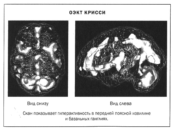 Мозг и душа. Новые открытия о влиянии мозга на характер, чувства, эмоции