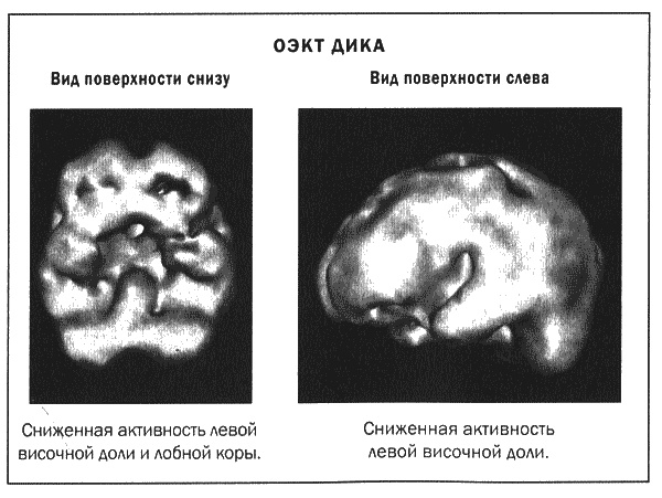 Мозг и душа. Новые открытия о влиянии мозга на характер, чувства, эмоции