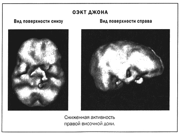 Мозг и душа. Новые открытия о влиянии мозга на характер, чувства, эмоции