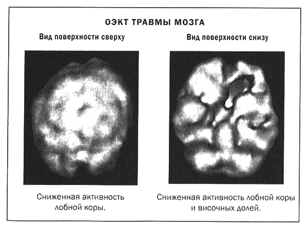 Мозг и душа. Новые открытия о влиянии мозга на характер, чувства, эмоции