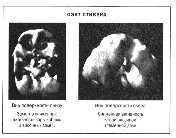 Мозг и душа. Новые открытия о влиянии мозга на характер, чувства, эмоции