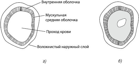 Здоровое сердце