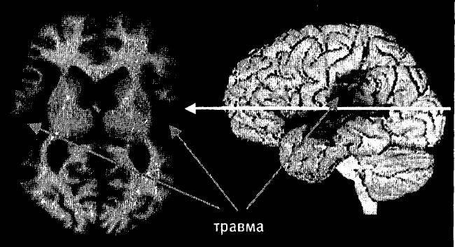 Мозг и душа. Как нервная деятельность формирует наш внутренний мир