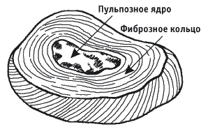 Грыжа позвоночника. Безоперационное лечение и профилактика