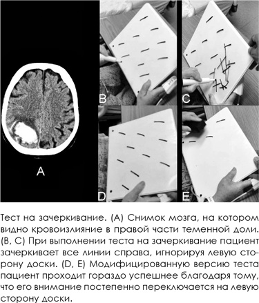 НейроЛогика. Чем объясняются странные поступки, которые мы совершаем неожиданно для себя