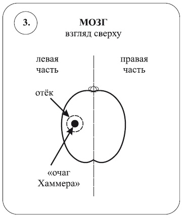 Исцеление воспоминанием