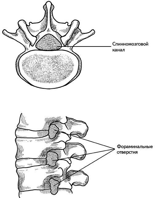 Жизнь без боли в спине. Лечение сколиоза, остеопороза, остеохондроза, межпозвонковой грыжи без операции