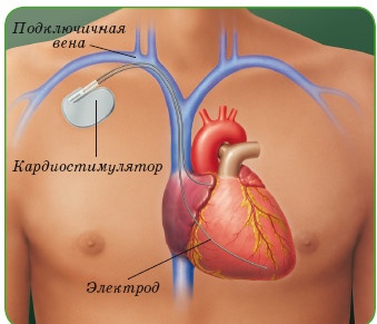 Энциклопедия диагностики и лечения от А до Я