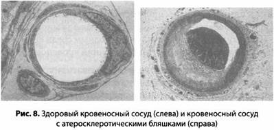 Психология стресса