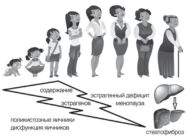 Неалкогольная жировая болезнь печени