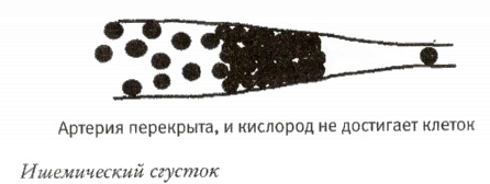 Мой инсульт был мне наукой. История собственной болезни, рассказанная нейробиологом