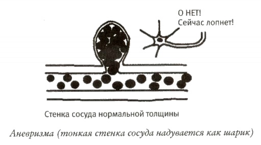 Мой инсульт был мне наукой. История собственной болезни, рассказанная нейробиологом