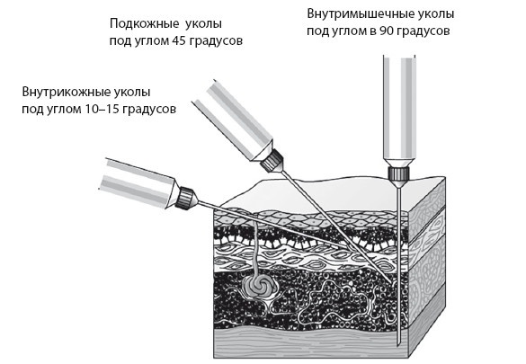 Уколы, капельницы, перевязки и другие медицинские процедуры и манипуляции