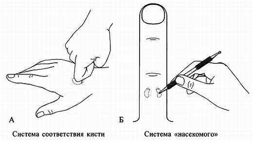 Сам себе Су Джок доктор