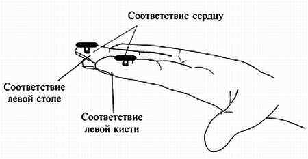 Сам себе Су Джок доктор