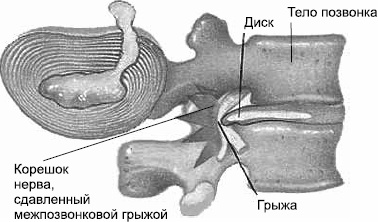 Заболевания позвоночника. Карманный справочник