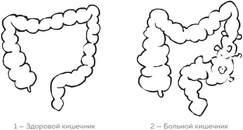 Кишечник. Как у тебя дела?