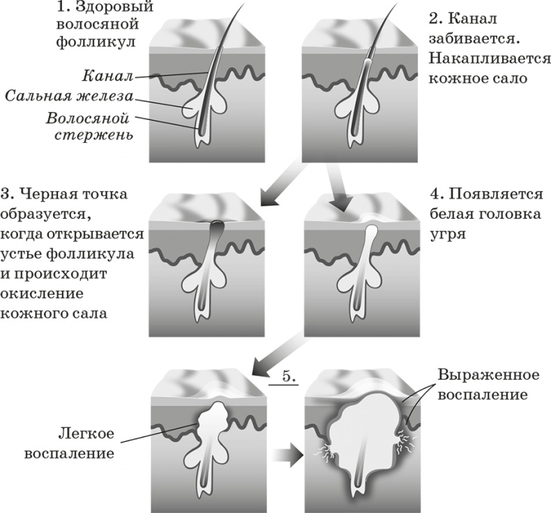 Как обмануть возраст