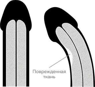 Мужское здоровье. Как у вас с ним?