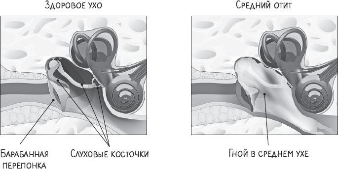 В лабиринтах уха, горла и носа. Скрытые механизмы работы, неочевидные взаимосвязи и полезные знания, которые помогут «дотянуть» до визита к врачу